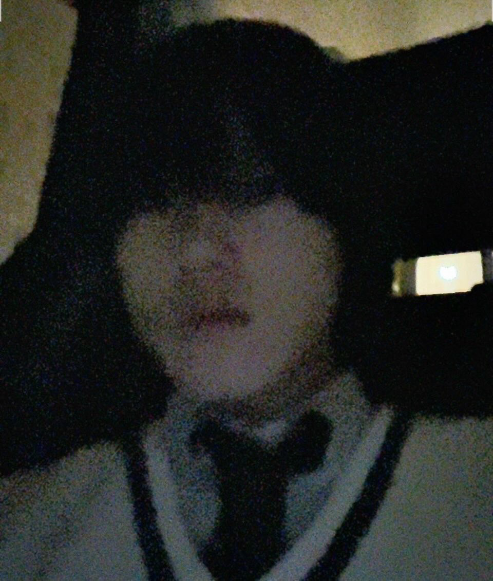 雨
